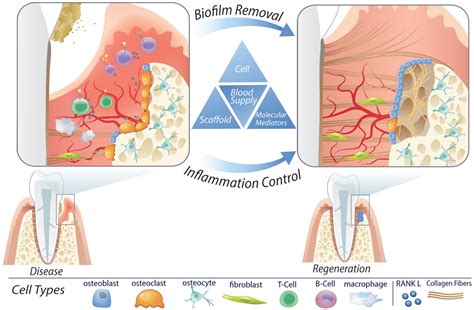 Keratin - En biologisk Superhjälte för Medicinska Implantat och Regenerativ Medicin!